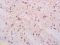 Neuropilin 1 Rabbit pAb